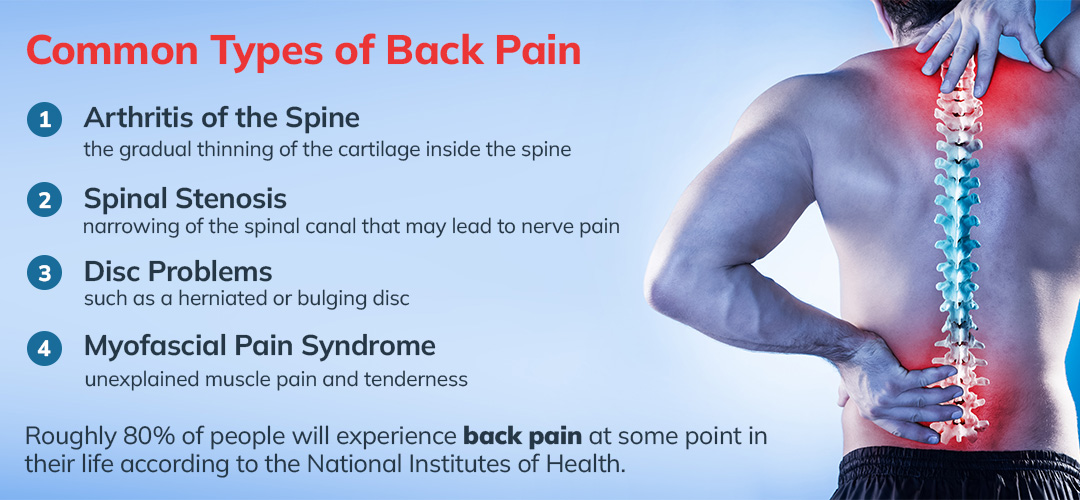 Understanding Back Pain - Hyderabad Physiotherapy